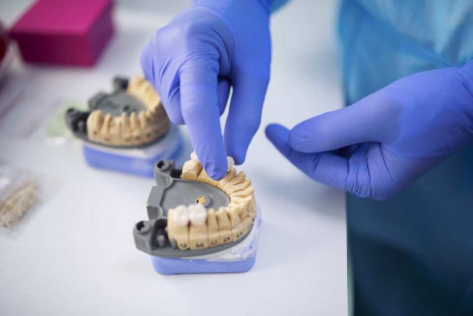 dentist showing a model of a dental crown in Brantford